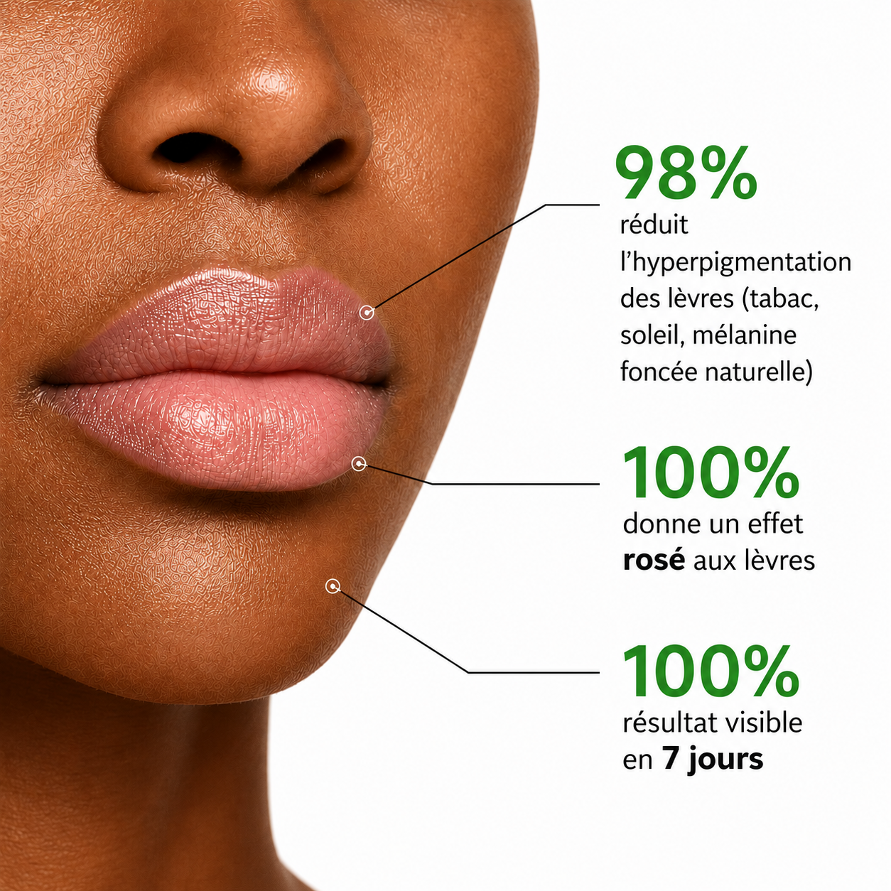 Baume ECLEA · Anti-hyperpigmentation des lèvres.