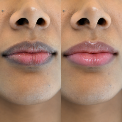 Baume ECLEA · Anti-hyperpigmentation des lèvres.
