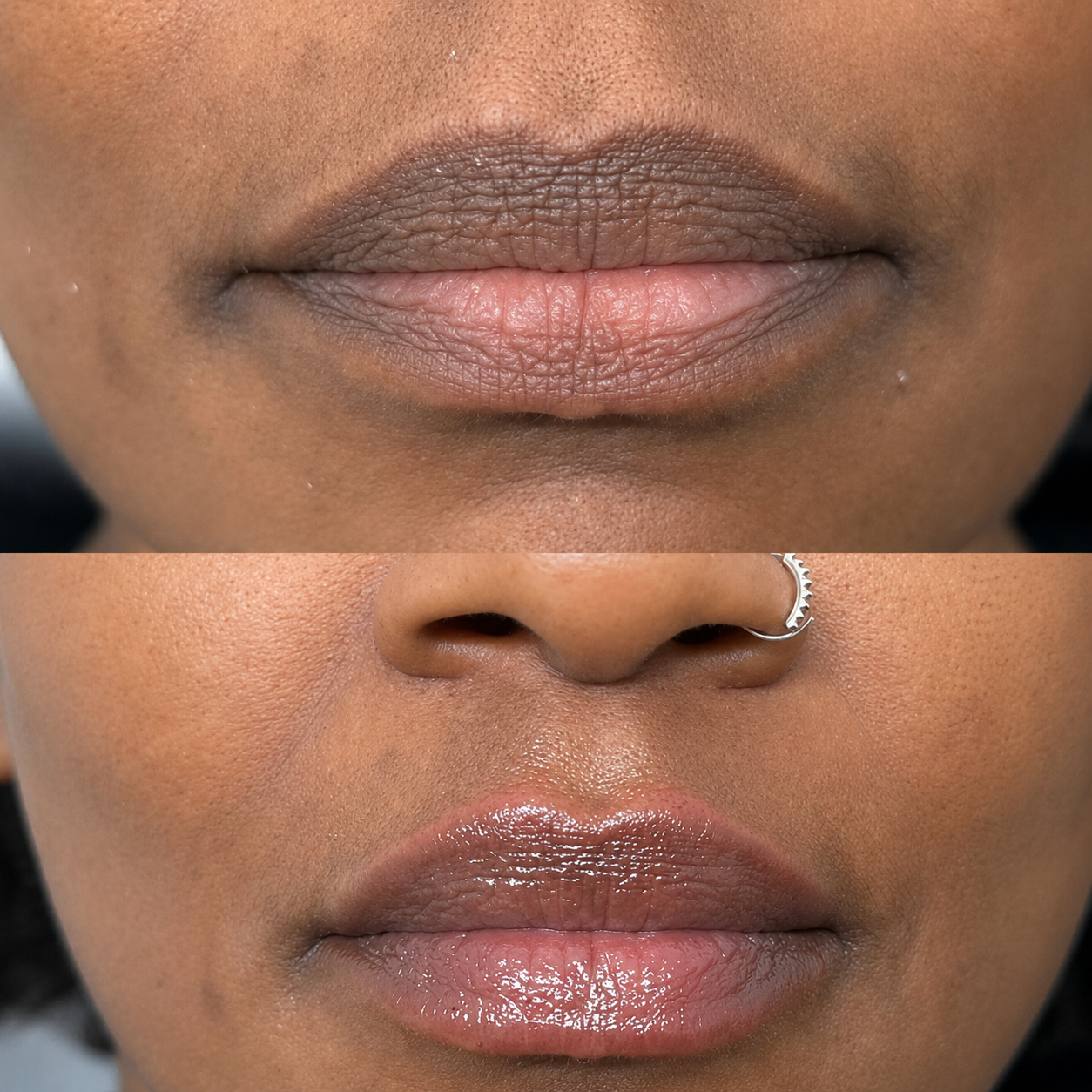 Baume ECLEA · Anti-hyperpigmentation des lèvres.