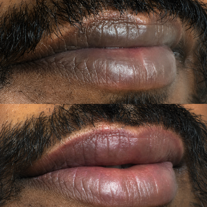 Baume ECLEA · Anti-hyperpigmentation des lèvres.
