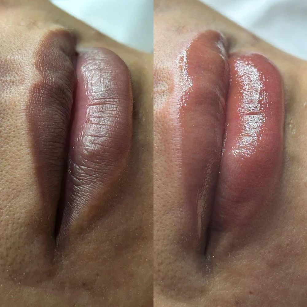 Baume ECLEA · Anti-hyperpigmentation des lèvres.