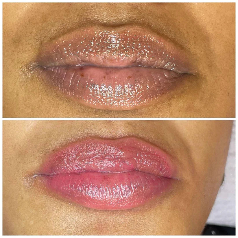 Baume à lèvre au curcuma - anti pigmentation et éclaircissant